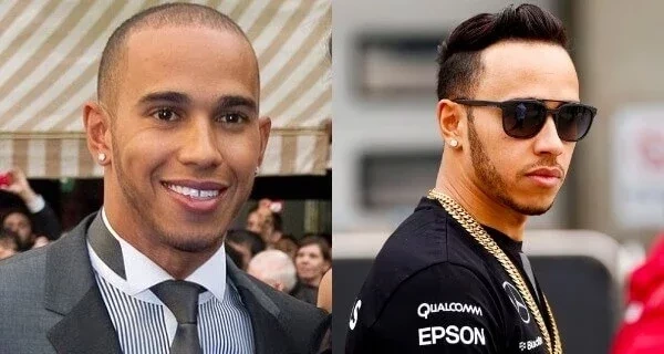 Confira fotos de atletas antes das cirurgias que são inacreditáveis  - imagem 12703