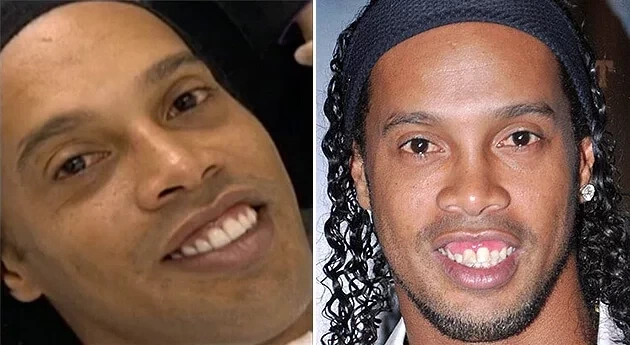 Confira fotos de atletas antes das cirurgias que são inacreditáveis  - imagem 12683