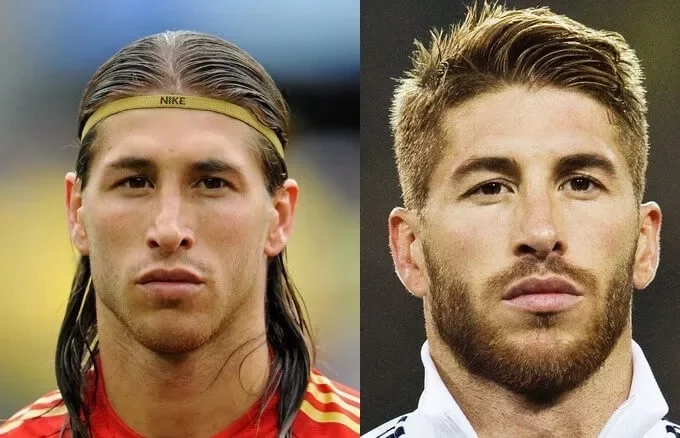 Confira fotos de atletas antes das cirurgias que são inacreditáveis  - imagem 12685