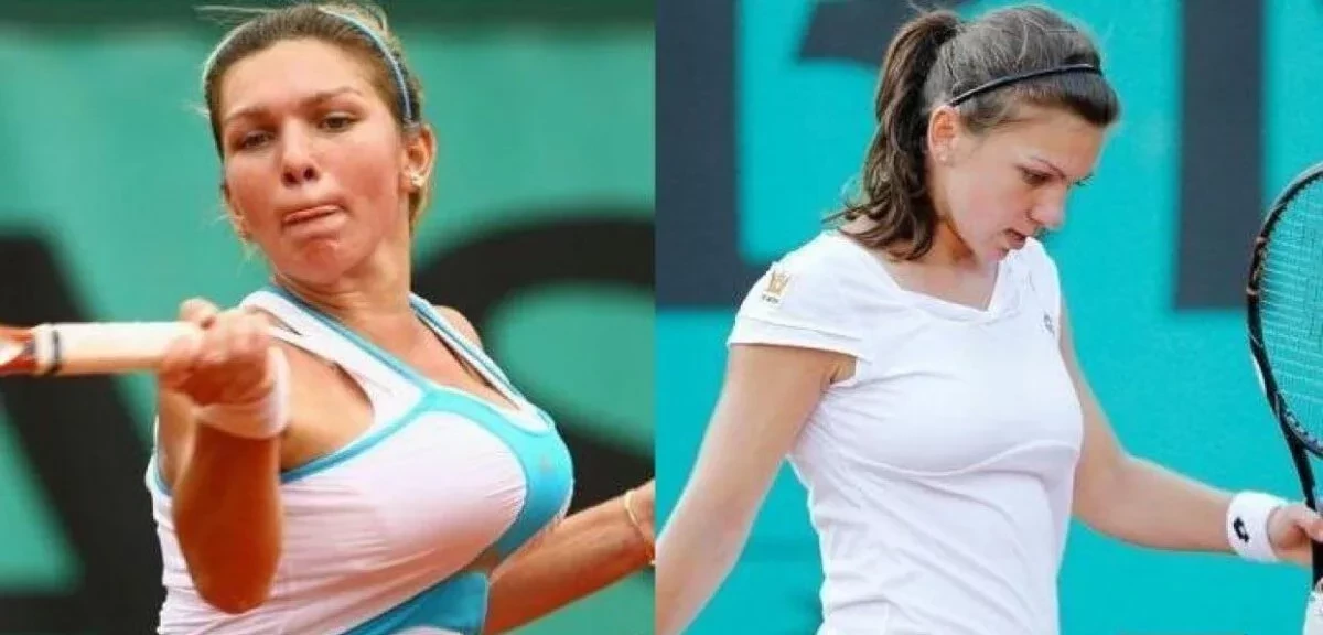 Confira fotos de atletas antes das cirurgias que são inacreditáveis  - imagem 12692