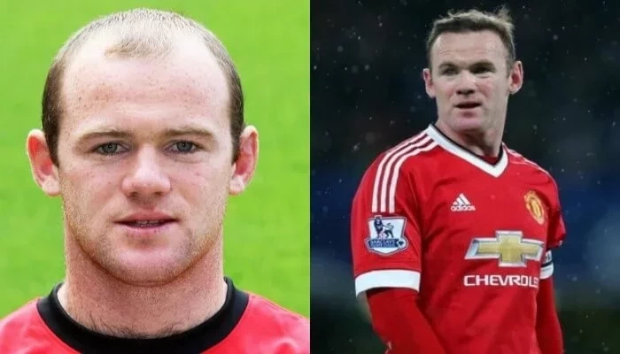 Confira fotos de atletas antes das cirurgias que são inacreditáveis  - imagem 12696