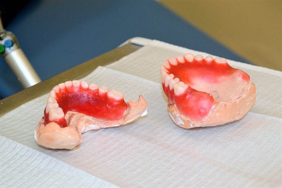 Prefeitura de Joaquim Pires entrega a primeira etapa de próteses dentarias - Imagem 3