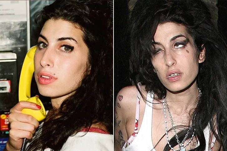 Confira o antes e depois de algumas celebridades - imagem 247