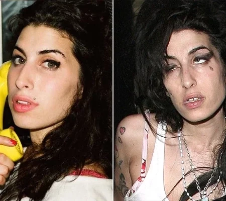 Confira o antes e depois de algumas celebridades