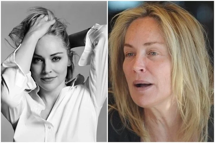 Confira o antes e depois de algumas celebridades - imagem 253