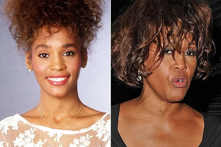 Confira o antes e depois de algumas celebridades - imagem 238