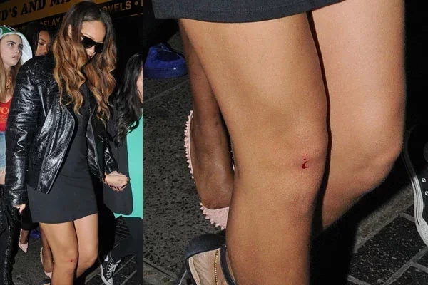 Veja casos lamentáveis de celebridades atacadas pelos próprios fãs - imagem 4934