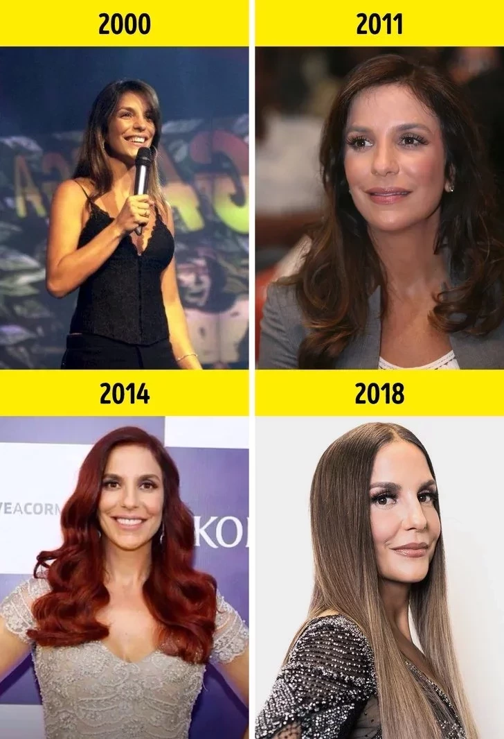 Veja a mudança na aparência de 15 cantoras nacionais ao longo dos anos - imagem 5761