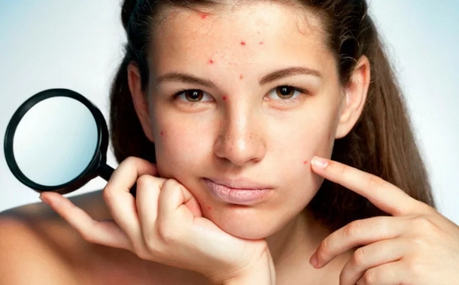 Como é a TPM da mulher de cada signo? Dicas para diminuir o incômodo! - imagem 6145