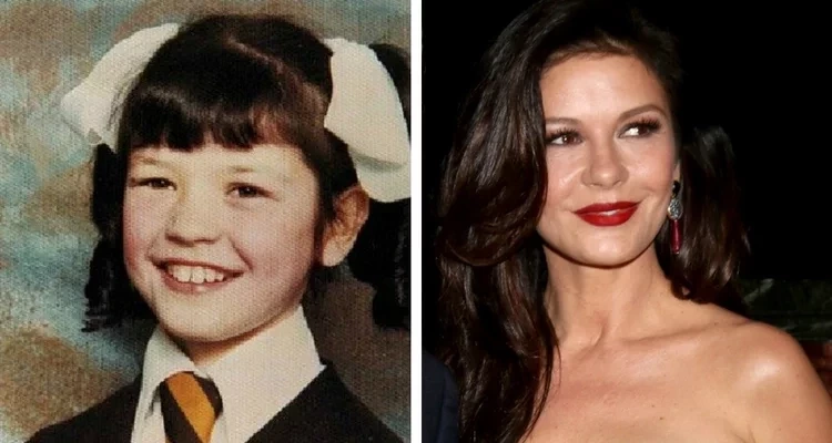 Veja fotos de 17 patinhos feios que se transformaram em famosos lindos - imagem 6707