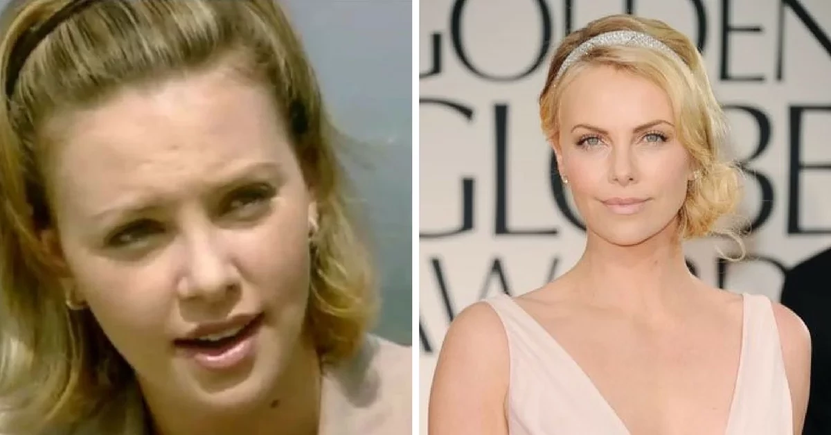 Veja fotos de 17 patinhos feios que se transformaram em famosos lindos - imagem 6714