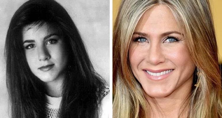 Veja fotos de 17 patinhos feios que se transformaram em famosos lindos - imagem 6715