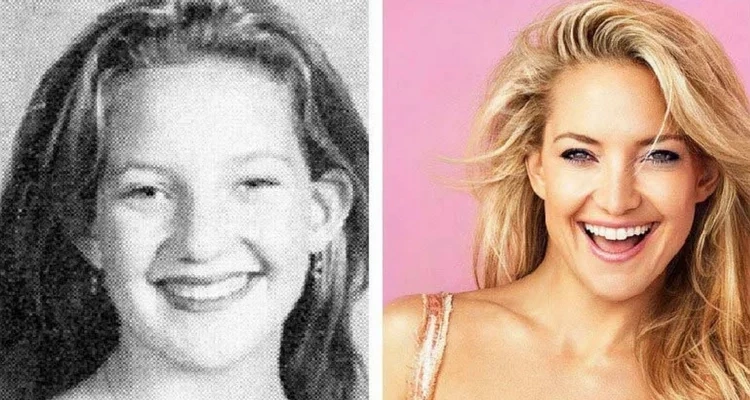 Veja fotos de 17 patinhos feios que se transformaram em famosos lindos - imagem 6712