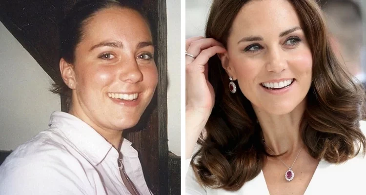 Veja fotos de 17 patinhos feios que se transformaram em famosos lindos - imagem 6713