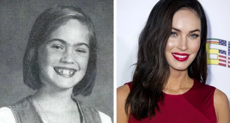 Veja fotos de 17 patinhos feios que se transformaram em famosos lindos - imagem 6706