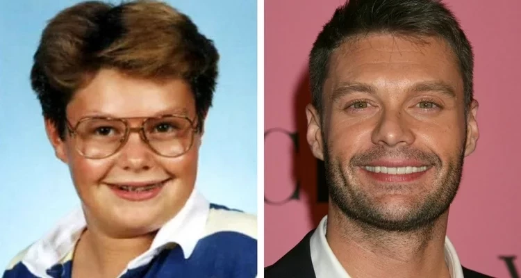 Veja fotos de 17 patinhos feios que se transformaram em famosos lindos - imagem 6718