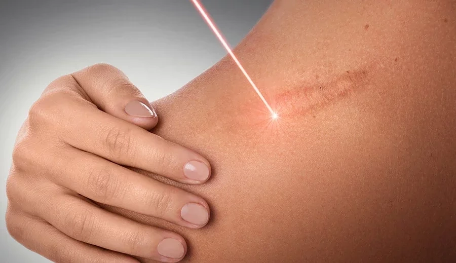 Reencarnação: Veja as histórias relatadas mais impressionantes - imagem 13615