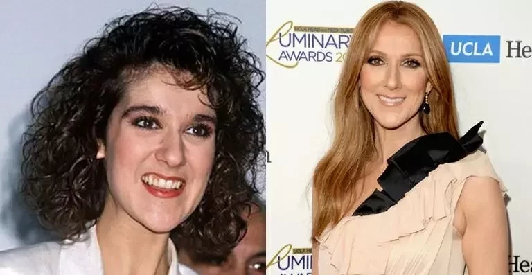 Confira como eram as cantoras pop mundiais antes da fama - imagem 13927