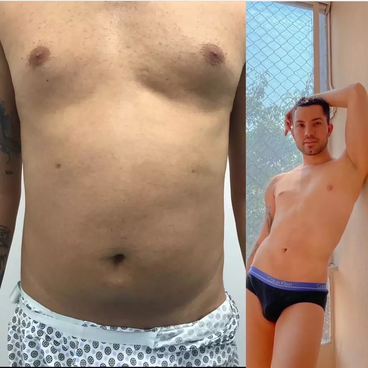 Aretuza Lovi exibe antes e depois de lipo e cirurgia no bumbum; fotos - imagem 28006