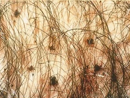 Confira 7 coisas que causam coceira no pênis e você não sabia - imagem 29573