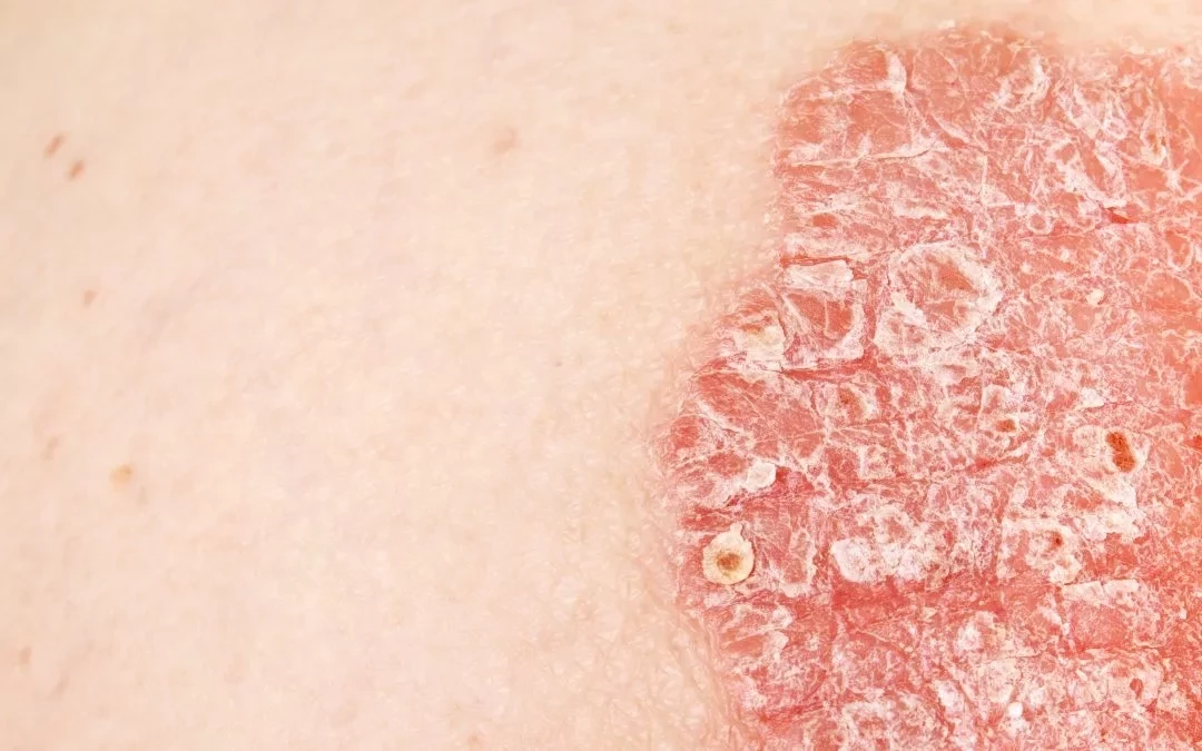 Confira 7 coisas que causam coceira no pênis e você não sabia - imagem 29572