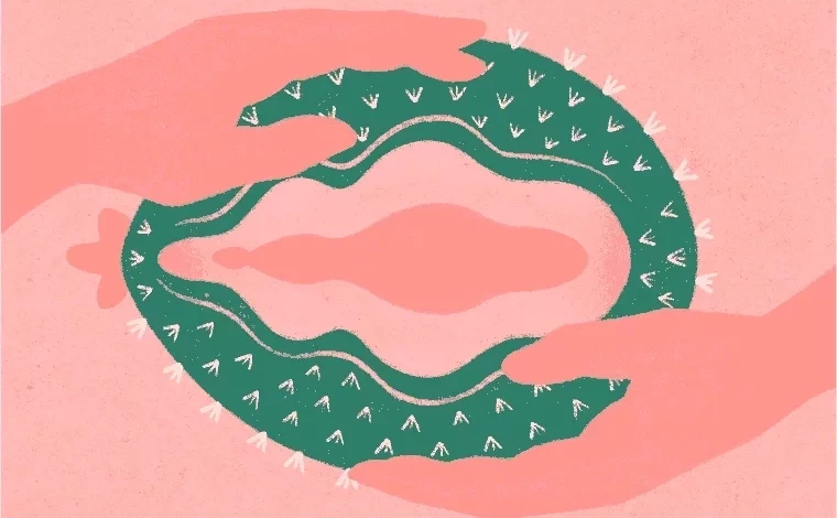 Sente ardência na vagina? Descubra o que pode ser e como tratar  - imagem 29579