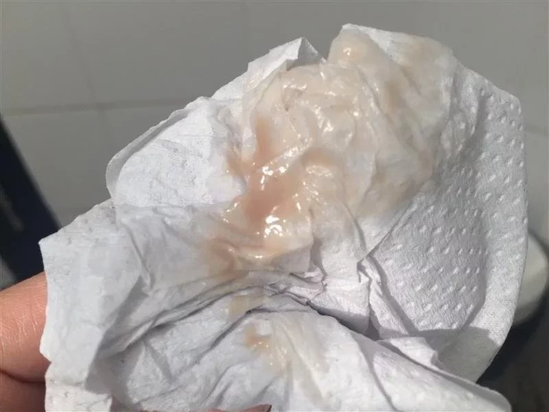 Suspeita de gravidez: Conheça 14 sinais de que você pode estar grávida - imagem 29722