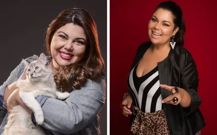 15 celebridades que mudaram muito depois de fazer cirurgia bariátrica - imagem 29955