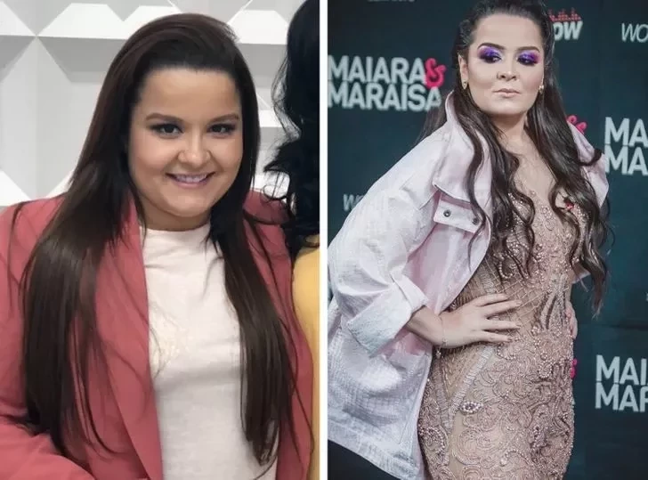 15 celebridades que mudaram muito depois de fazer cirurgia bariátrica - imagem 29965