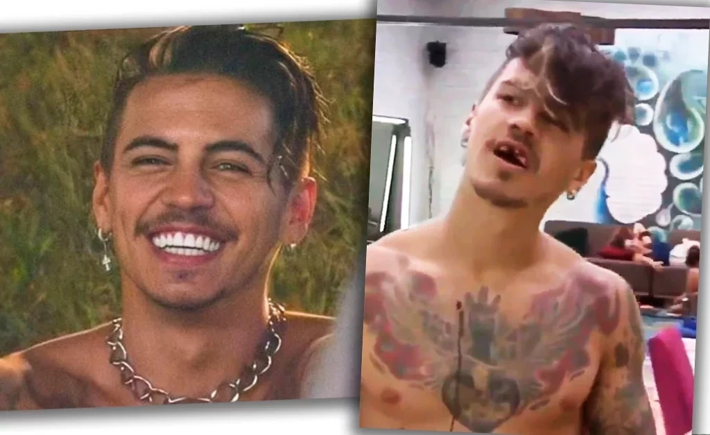 Veja os famosos que apostaram na lente de contato dental - imagem 30540