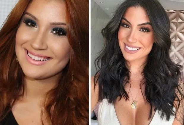 Veja os famosos que apostaram na lente de contato dental - imagem 30543