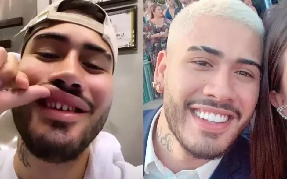 Veja os famosos que apostaram na lente de contato dental - imagem 30539