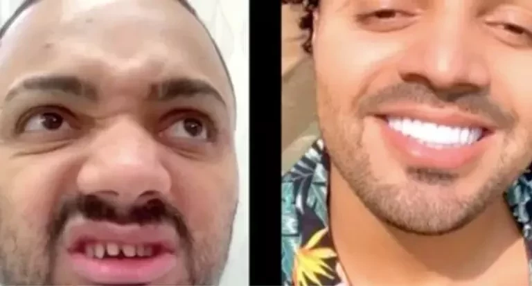 Veja os famosos que apostaram na lente de contato dental - imagem 30545