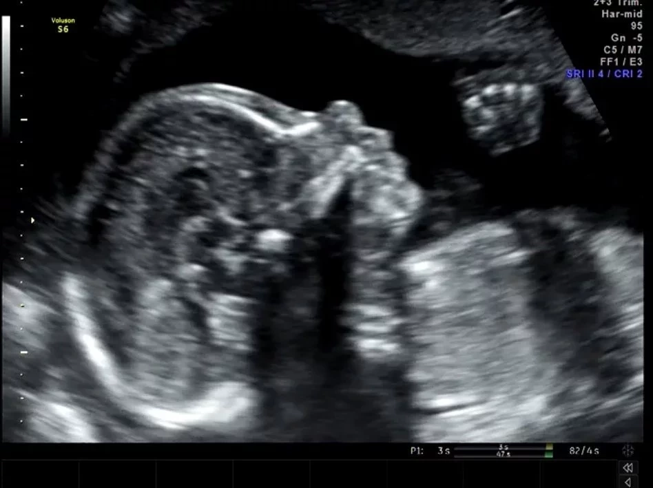 BBB20: Conheça 10 curiosidades do BBB Pyong Lee que você não sabia - imagem 15620