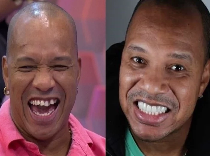 Confira antes e depois dos sorrisos das celebridades após a fama - imagem 15781