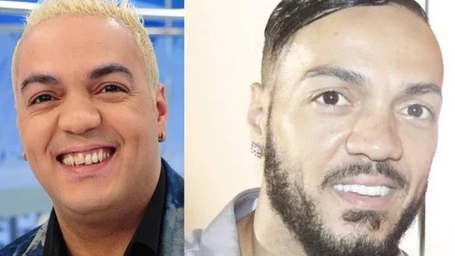 Confira antes e depois dos sorrisos das celebridades após a fama - imagem 15782