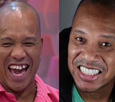 Confira antes e depois dos sorrisos das celebridades após a fama