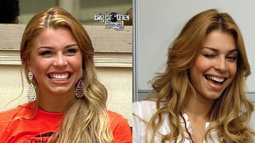 Confira antes e depois dos sorrisos das celebridades após a fama - imagem 15778