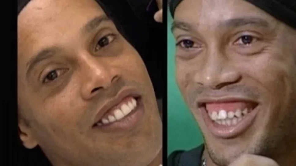 Confira antes e depois dos sorrisos das celebridades após a fama - imagem 15779