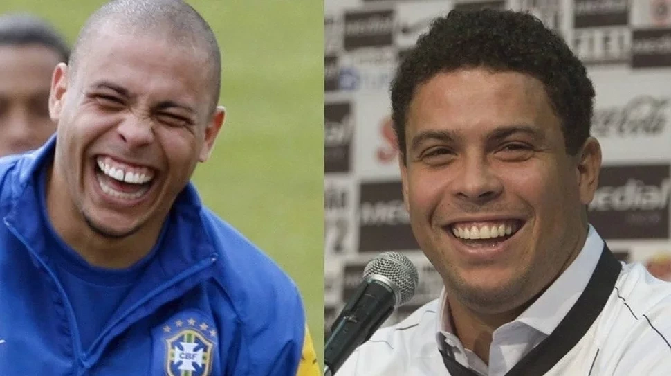 Confira antes e depois dos sorrisos das celebridades após a fama - imagem 15780