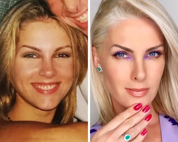 Confira os Antes e Depois das grandes apresentadoras brasileiras - imagem 15424
