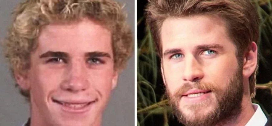 Confira os galãs de Hollywood que já sofreram bullying na infância - imagem 18283