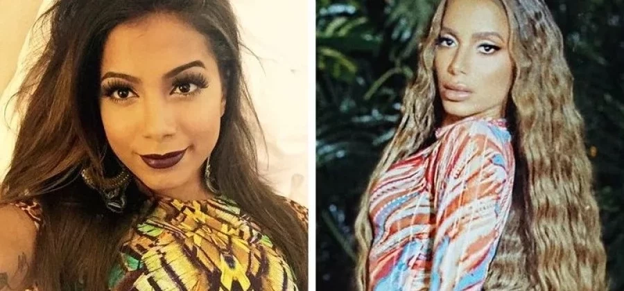 Veja as celebridades que mudaram de forma drástica em apenas 5 anos - imagem 17063