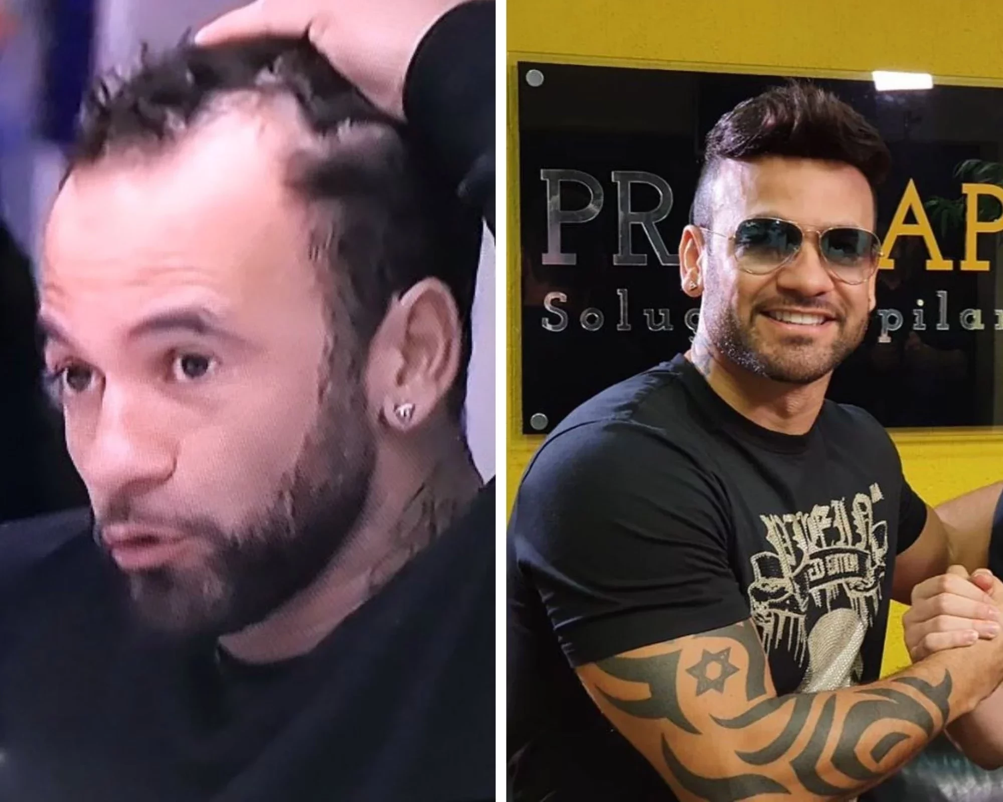 BBB 20: Veja como estão e o que mudou nos participantes do reality - imagem 19499