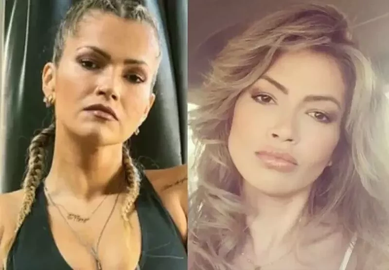 Veja o antes e depois das famosas que fizeram harmonização facial - imagem 20333