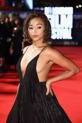 Saiba quem são as celebridades que assumiram os pelos nas axilas  - imagem 20890