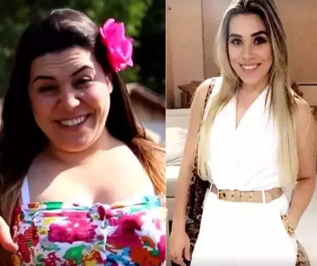 Antes e depois: Cantoras que recorreram ao bisturi e se transformaram  - imagem 22056