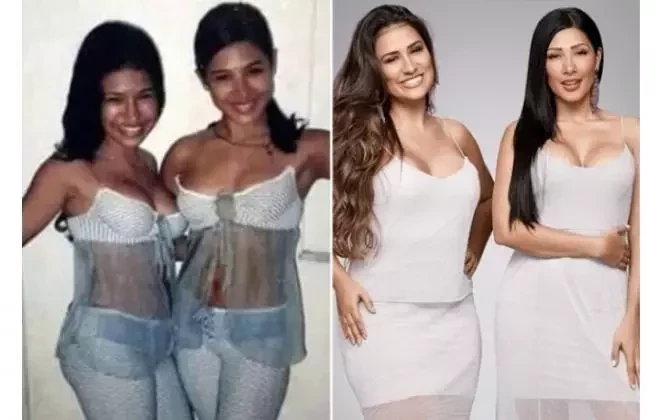 Antes e depois: Cantoras que recorreram ao bisturi e se transformaram  - imagem 22057