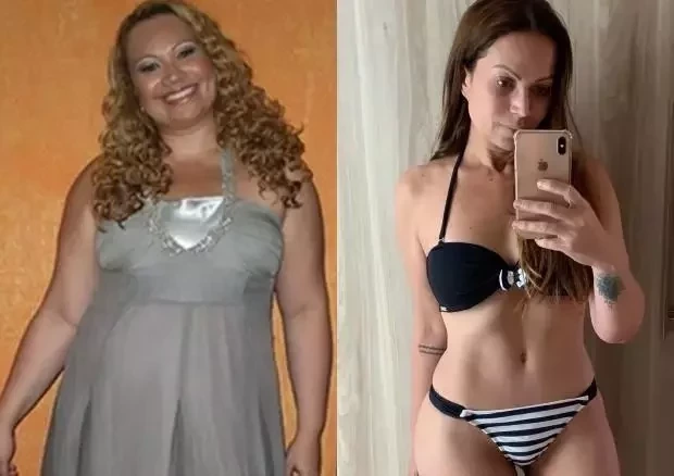 Antes e depois: Cantoras que recorreram ao bisturi e se transformaram  - imagem 22053