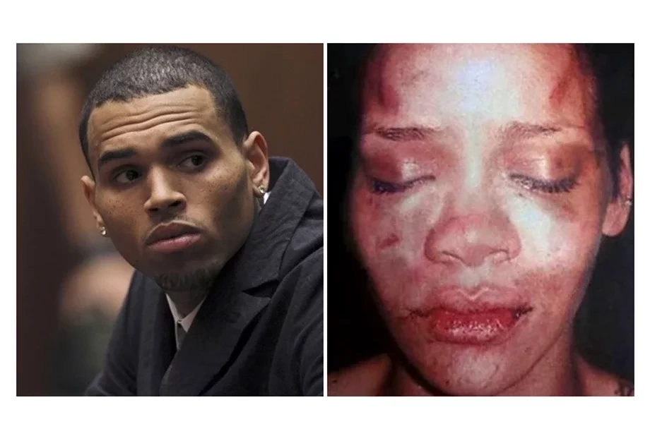 Relembre as celebridades que já se envolveram em casos de agressões  - imagem 22129